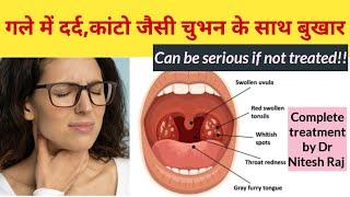 Sore throat  गले मे दर्द कांटो जैसी चुभन बुखार और गाढ़ा बलगम का इलाज़ by Dr Nitesh Raj