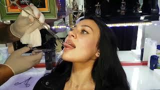 Lokal Anesteziyle Dil Piercing Delimi