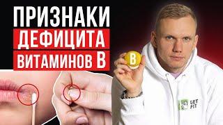 Симптомы и признаки нехватки витаминов группы B  Как проявляется дефицит витаминов Б?