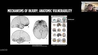 Maladaptive Microcircuits Interrogating Selective Vulnerability after Traumatic Brain Injury