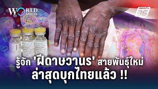 รู้จัก ฝีดาษวานร สายพันธุ์ใหม่ ล่าสุดบุกไทยแล้ว   World Stories