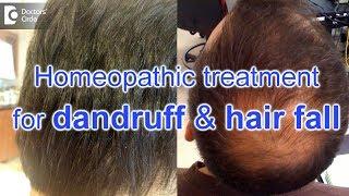 Homeopathic treatment for dandruff and hair fall - Dr. Surekha Tiwari