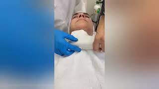 Is HIFU a better alternative for fat removal and skin tightening for the face compare to surgery?