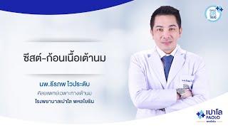 ซีสต์-ก้อนเนื้อเต้านม