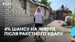 Історія жительки Зарічного на Запоріжжі яка пережила ампутацію внаслідок обстрілу РФ