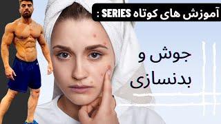 آموزشی های کوتاه  این قسمت جوش و آکنه