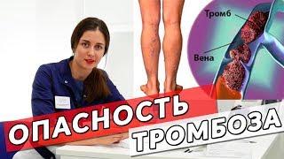 Как распознать тромбоз глубоких вен?