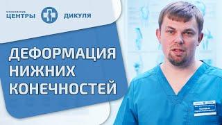  Деформация стопы - что делать как исправить? Отвечает ортопед. Деформация стопы что делать. 12+