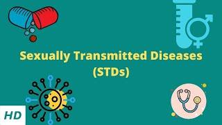 Sexually Transmitted Diseases STDs Causes Signs and Symptoms Diagnosis and Treatment.