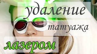 УДАЛЕНИЕ ТАТУАЖА ЛАЗЕРОМ. СКОЛЬКО Я НОШУ ПЕРМАНЕНТНЫЙ МАКИЯЖ КАК  УДАЛИТЬ ЛАЗЕРОМ МОЙ ОПЫТ.