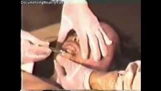 Chinese female autopsy head to toe examination followed by full evisceration