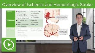 Overview of Ischemic and Hemorrhagic Stroke  Clinical Neurology