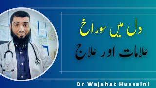 Hole in the Heart  Dil Main Suraakh  By Dr Wajahat Hussaini  UrduHindi