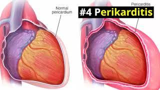 Penyebab-Penyebab Sakit Dada Sebelah Kiri