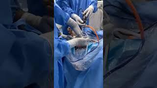 Ankle pain . arthroscopic Ankle ligament surgery at advance hospitals