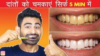 मोतियों जैसे चमकेंगे पीले दांत इस घरेलू नुस्खे से  TEETH WHITENING AT HOME Works 100%