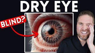 6 Ways Dry Eyes Can Affect Your Eyes And Vision Can You Go Blind?