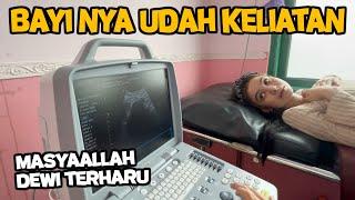 INI BAYI DEWI UDAH KELIATAN? PERTAMA KALI CEK KE DOKTER‼️ BEGINI RESPON MAMAH CHERRY LIAT DEWI HAMIL