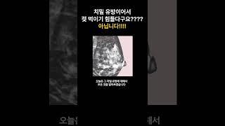 치밀 유방이어서 젖 먹이기 힘들다구요???? 아닙니다