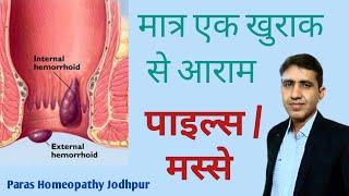 मस्से  पाइल्स  बवासीर का परमानेंट इलाज  Best Homeopathic Medicine For piles  Piles Treatment