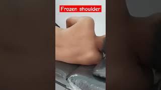 Frozen shoulder#pijatterapimasyanto #feed #frozenshoulder