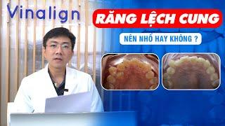 Răng Lệch Cung Hàm - Nên Nhổ Hay Không ?  Nam Bùi Vinalign