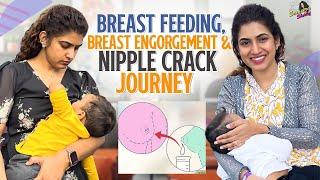 My Breastfeeding Breast Engorgement & Cracked Nipple Journey  Sameera Sherief