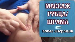 Массаж рубца шрама после операци. Self- Massage of the Scar after Surgery English subtitles.