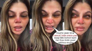 Rakhi Sawant Crying badly in her Last Video🟢 after losing in Cancer and Surgery at Hospital