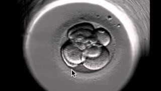 ivf embryo developing over 5 days by fertility Dr Raewyn Teirney