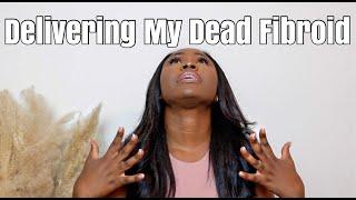 My Fibroid Died Inside of Me  Story Time  Fibroid Awareness