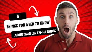 6 things you need to know about swollen lymph nodes or swollen glands #SpotLeukaemia