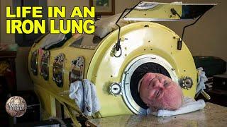 What Its Like to Be In an Iron Lung