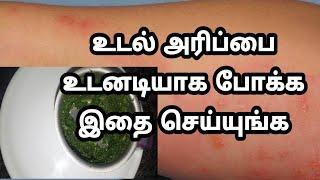 வெயிலுக்கு வரும் அரிப்பை போக்க சூப்பரான டிப்ஸ்உடல் அரிப்புBody itching Home Remedies