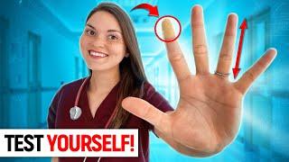 What your HANDS say about your HEALTH Doctor Explains