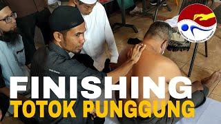 Finishing Terapi Totok Punggung