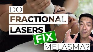 Should you use Fractional Lasers?  Dr Davin Lim