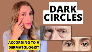 Can You Get Rid of Dark Circles Under Your Eyes? Dermatologist Explains  Dr. Sam Ellis