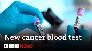 Blood test for more than 50 cancers shows promise in study - BBC News