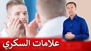 ٧ علامات جلدية تحذرك من مرض السكري لا تهملها