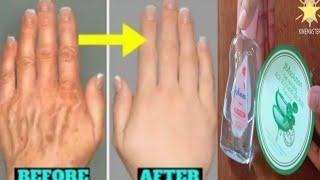 แก้มือเหี่ยว มือขาวสวยใส How To Make Hands White And Wrinkle-free With Aloe vera and Baby Oil