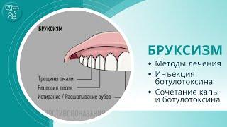 Бруксизм. Методы комплексного лечения бруксизма в медицинском центре Биомеханика