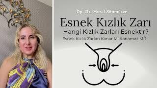 Esnek Kızlık Zarı Genel Bilgilendirme. Op. Dr. Meral Sönmezer