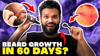 I Grew My Beard In 60 Days SHOCKING RESULTS  Beardo Beard Growth Challenge  BeYourBest San Kalra