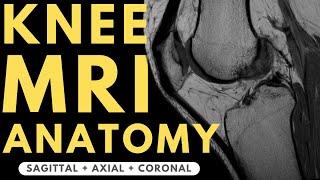Knee MRI Anatomy  Radiology anatomy part 1 prep  How to interpret a knee MRI