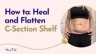 How to Flatten and Heal C-Section shelf - with Wendy Perinatal Pelvic Health Expert