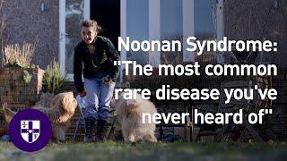 Noonan Syndrome The most common rare disease youve never heard of