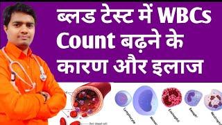 High Wbcs Count In Blood  ब्लड में WBCs बढ़ने के कारण और इलाज  High Wbc Count Treatment In Hindi