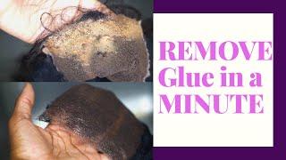 HOW TO CLEAN GLUE OFF YOUR LACE