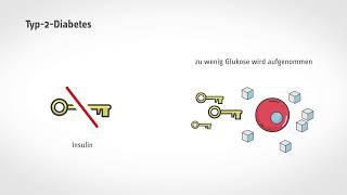 Kurz und verständlich Was passiert bei Diabetes?